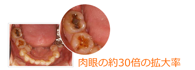 肉眼の約30倍の拡大率